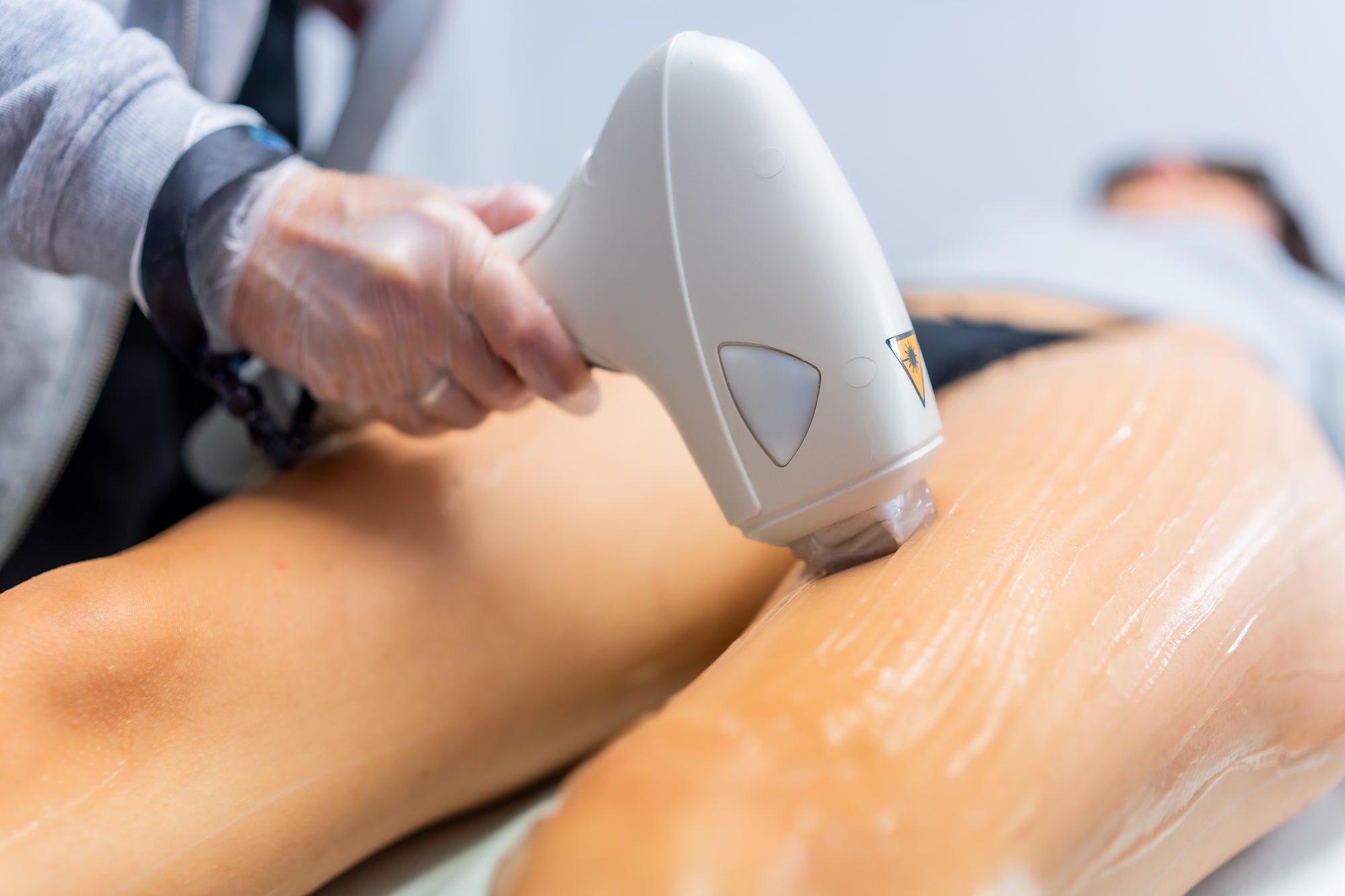 Soin en promo - épilation au laser