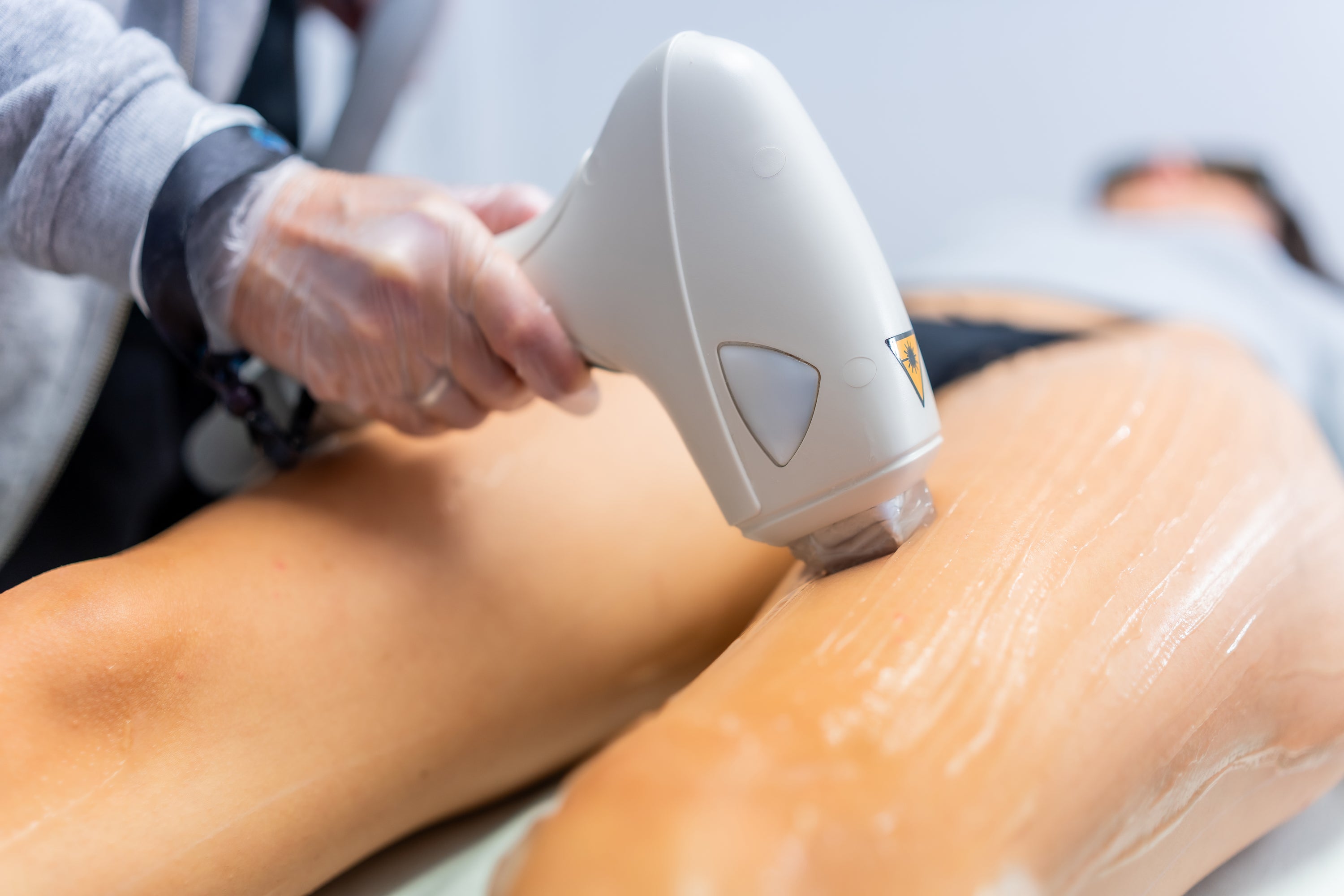 Soin en promo - épilation au laser